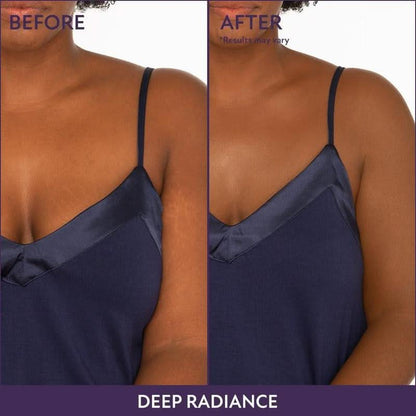 🔥VENTE DU DERNIER JOUR 50% DE RÉDUCTION !✨Body Coverage Perfector - Maquillage corporel imperméable, léger et impeccable