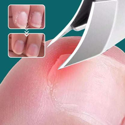 🔥2025 Vente à chaud🔥 Set de 3 pièces de coupe-ongles à bord incliné 25° anti-éclaboussures